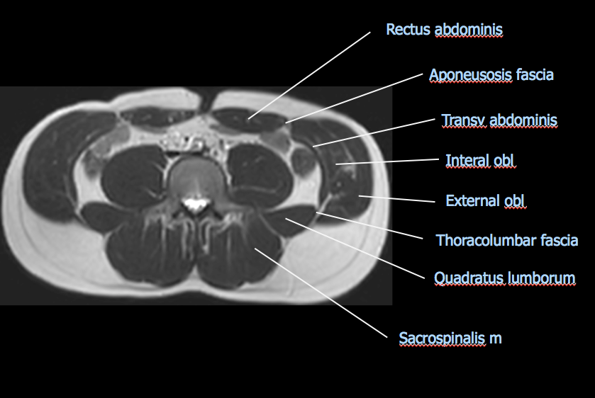 Medical image