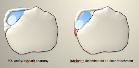 ECU anatomy