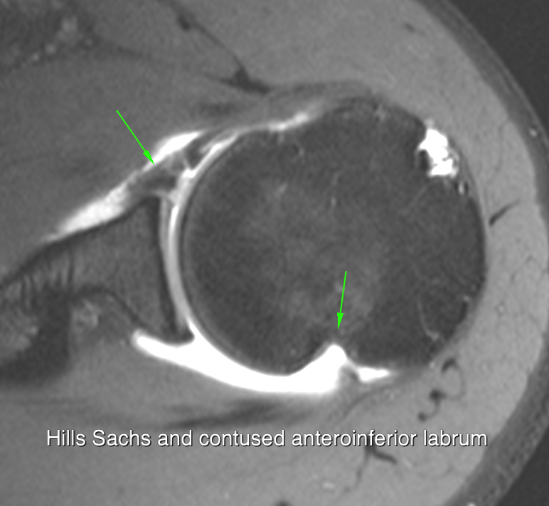 Dislocation imaging