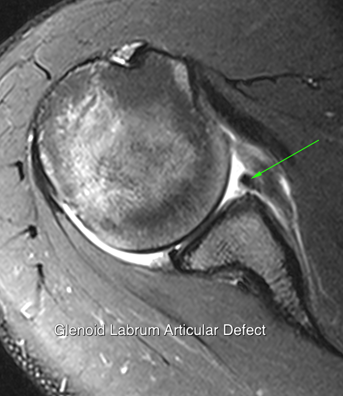 Dislocation imaging
