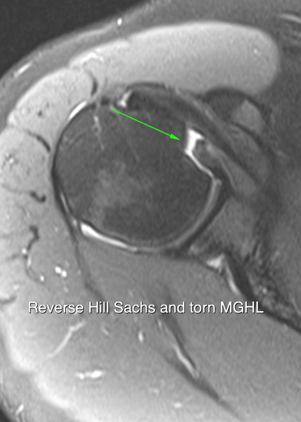 Dislocation imaging